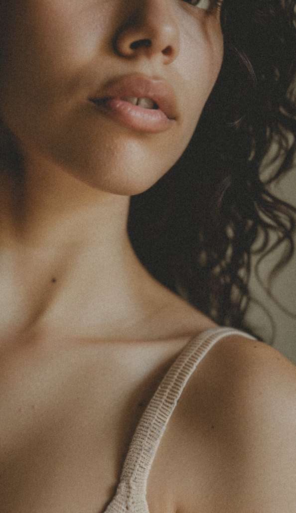 Ergebnis nach Rosacea Gesichtsbehandlung – beruhigte, strahlende Haut