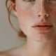 Nahaufnahme einer jungen Frau mit sensitiver, zu Rötungen neigender Haut – Beispielbild für das Skin Renewal Facial bei Rosacea und Couperose