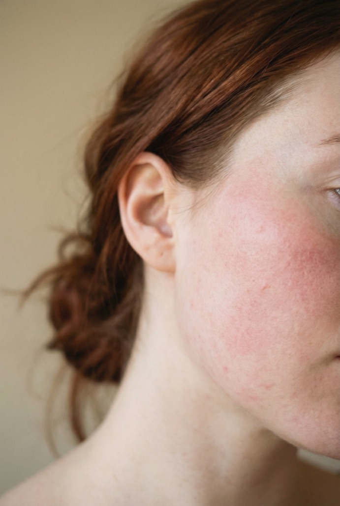 Corrective Facial im Kosmetikstudio Winterhude – Behandlung bei Hautproblemen